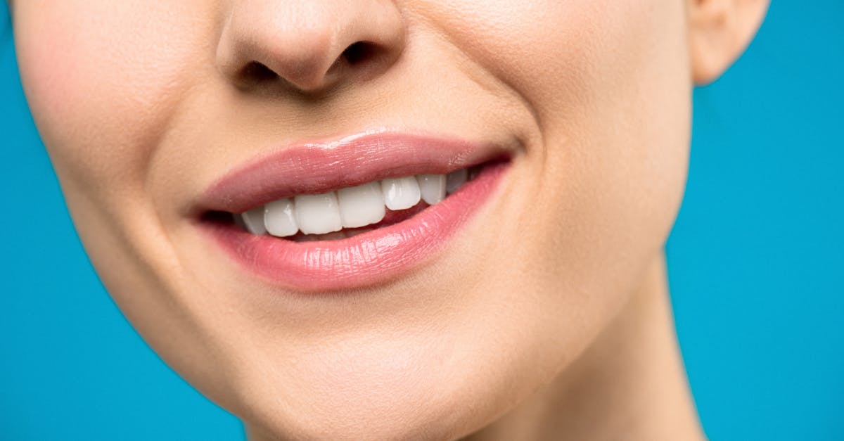 Teeth Whitening Close-up of a bright, white smile after professional teeth whitening